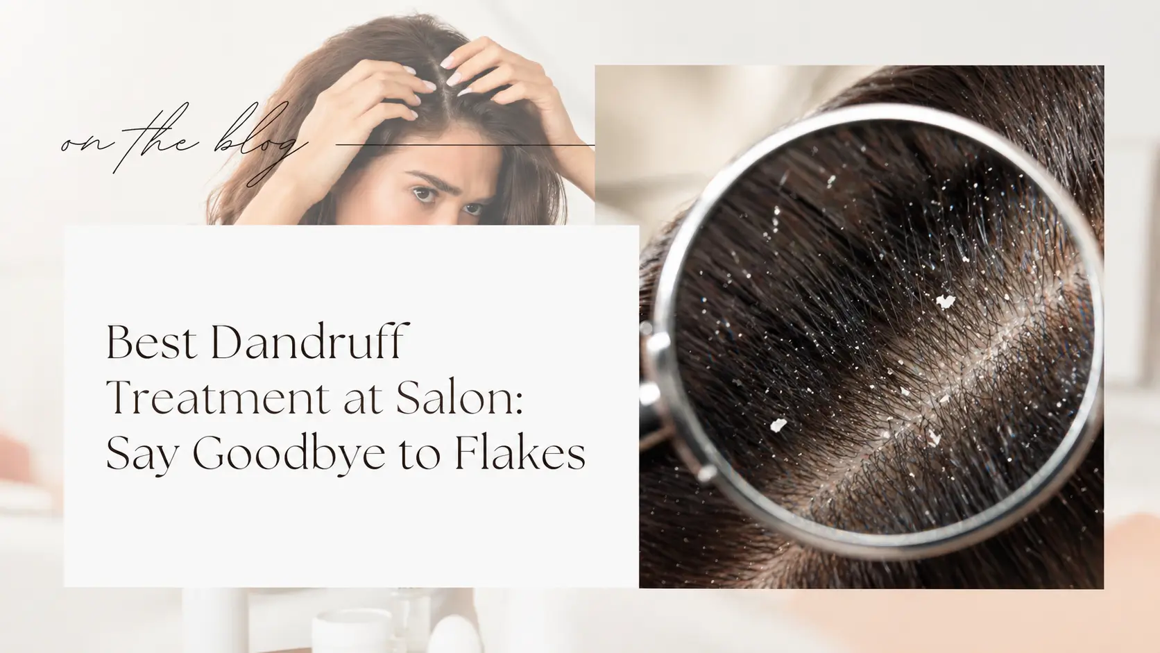 Best Dandruff Treatment at Salon: Say Goodbye to Flakes